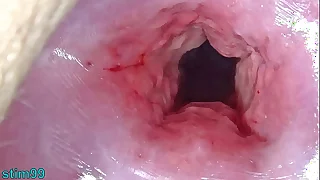 Uncensored Japanese Cervix Stretching and Uterus Dilation with Penetration